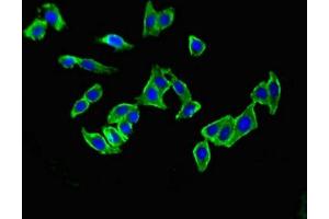 Immunofluorescent analysis of HepG2 cells using ABIN7159432 at dilution of 1:100 and Alexa Fluor 488-congugated AffiniPure Goat Anti-Rabbit IgG(H+L) (Metabotropic Glutamate Receptor 1 antibody  (AA 880-1017))