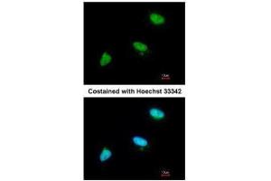 ICC/IF Image Immunofluorescence analysis of paraformaldehyde-fixed A549, using CDC34, antibody at 1:200 dilution. (CDC34 antibody)