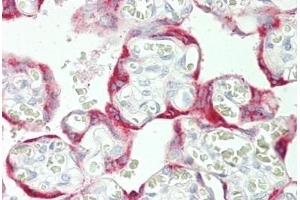 Human Placenta: Formalin-Fixed, Paraffin-Embedded (FFPE) (AMFR antibody  (AA 371-400))