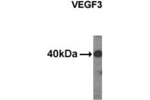 Western Blotting (WB) image for anti-Vascular Endothelial Growth Factor C (VEGFC) antibody (ABIN2995286)
