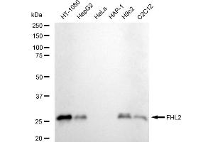Western blotting analysis using FHL2 antibody (ABIN7798656).
