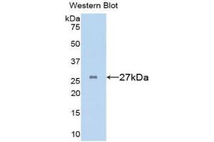 Western blot analysis of the recombinant protein. (Clusterin antibody  (AA 227-447))