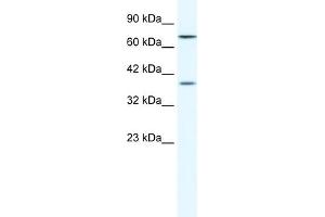 WB Suggested Anti-ZNF660 Antibody Titration:  1. (ZNF660 antibody  (C-Term))