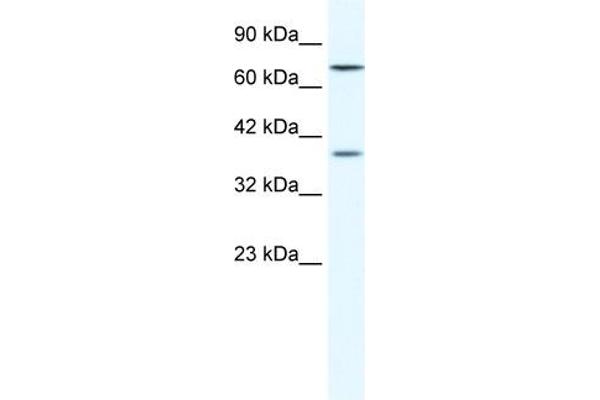 ZNF660 anticorps  (C-Term)