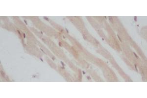 Immunohistochemistry of paraffin-embedded Mouse heart using ERG Polyclonal Antibody at dilution of 1:50 (ERG antibody)