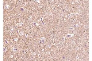 ABIN6268670 at 1/100 staining human brain tissue sections by IHC-P.
