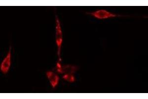 ABIN6275616 staining  CoLo205 cells by IF/ICC. (SYT11 antibody  (Internal Region))
