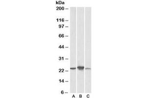 Western blot testing of human [A], mouse [B], rat [C] liver lysate with ABHD14B antibody at 0. (ABHD14B antibody)
