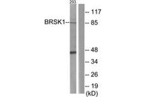 Western blot analysis of extracts from 293 cells, using BRSK1 Antibody. (BRSK1 antibody  (AA 361-410))