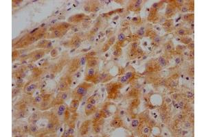 IHC image of ABIN7127528 diluted at 1:100 and staining in paraffin-embedded human liver tissue performed on a Leica BondTM system. (Recombinant Growth Hormone Receptor antibody)