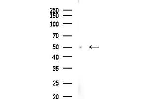 anti-Tubulin, epsilon 1 (TUBE1) (Internal Region) antibody