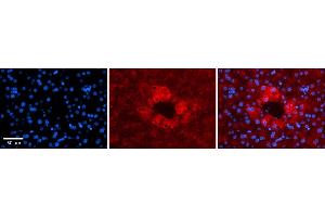 Rabbit Anti-APOH Antibody    Formalin Fixed Paraffin Embedded Tissue: Human Adult liver  Observed Staining: Cytoplasmic Primary Antibody Concentration: 1:600 Secondary Antibody: Donkey anti-Rabbit-Cy2/3 Secondary Antibody Concentration: 1:200 Magnification: 20X Exposure Time: 0. (APOH antibody  (N-Term))