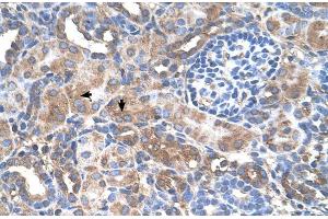 Human kidney (GALNT6 antibody  (N-Term))