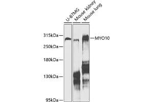 Western blot analysis of extracts of various cell lines, using MYO10 antibody (ABIN6128319, ABIN6144271, ABIN6144274 and ABIN6216113) at 1:1000 dilution. (Myosin X antibody  (AA 845-944))