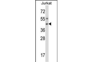 Mouse Nim1 Antibody (C-term) (ABIN657849 and ABIN2846810) western blot analysis in Jurkat cell line lysates (35 μg/lane). (NIM1 antibody  (C-Term))