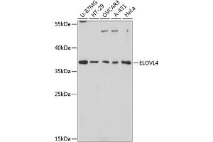 Western blot analysis of extracts of various cell lines, using ELOVL4 antibody (ABIN1679709, ABIN3017923, ABIN3017924 and ABIN6220305) at 1:3000 dilution.