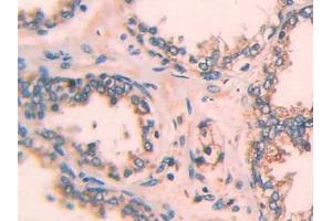 Used in DAB staining on fromalin fixed paraffin- embedded rectum cancer tissue (ECT2 antibody  (AA 166-348))