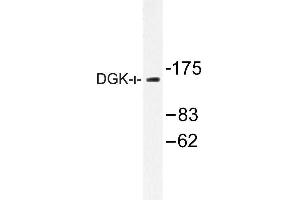 Image no. 1 for anti-Diacylglycerol Kinase, iota (DGKI) antibody (ABIN272146) (DGKI antibody)