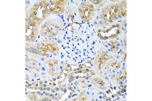 Immunohistochemistry of paraffin-embedded rat kidney using NIN antibody (ABIN5974918) at dilution of 1/100 (40x lens). (Ninein antibody)