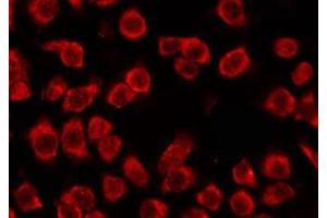 ABIN6278612 staining COLO205 by IF/ICC. (OR51G1 antibody)