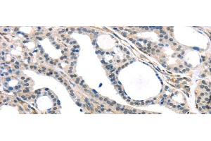 KDM5C antibody