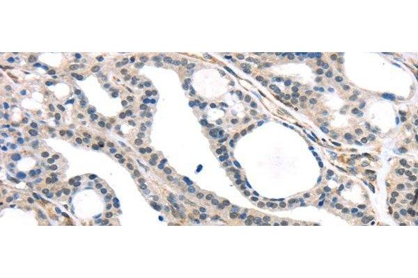 KDM5C antibody