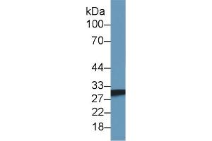 Detection of SDHB in Mouse Skeletal muscle lysate using Polyclonal Antibody to Succinate Dehydrogenase Complex Subunit B (SDHB) (SDHB antibody  (AA 97-282))