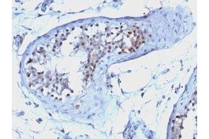 Formalin-fixed, paraffin-embedded human testicular carcinoma stained with Cyclin B1 antibody. (Cyclin B1 antibody)