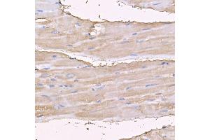 Immunohistochemistry of paraffin-embedded rat heart using MYH4 antibody (ABIN7268749) at dilution of 1:150 (40x lens).