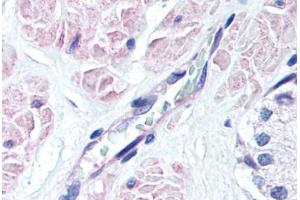 Human Prostate, Vessel (formalin-fixed, paraffin-embedded) stained with S1PR3 antibody ABIN337001 at 10 ug/ml followed by biotinylated goat anti-rabbit IgG secondary antibody ABIN481713, alkaline phosphatase-streptavidin and chromogen. (S1PR3 antibody  (AA 12-25))