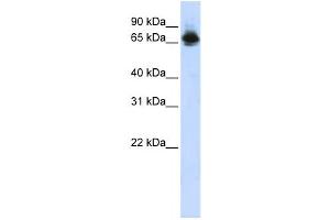 Western Blotting (WB) image for anti-Far Upstream Element (FUSE) Binding Protein 1 (FUBP1) antibody (ABIN2458167)