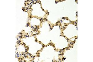 Immunohistochemistry of paraffin-embedded rat lung using DNMT3A Antibody (ABIN1872325) at dilution of 1:100 (40x lens). (DNMT3A antibody)