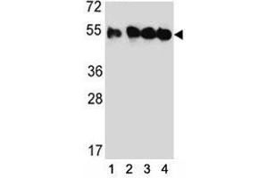 Western blot analysis of TUBB2C antibody and (1) HeLa, (2) MDA-MB435, (3) MDA-MB231, and (4) HepG2 lysate. (TUBB2C antibody  (AA 99-125))