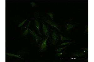 Immunofluorescence of monoclonal antibody to MEF2D on HeLa cell. (MEF2D antibody  (AA 256-351))