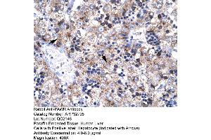 Human Liver (PAWR antibody  (Middle Region))