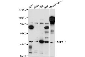 Western blot analysis of extracts of various cell lines, using AGPAT3 antibody (ABIN6291715) at 1:3000 dilution. (AGPAT3 antibody)