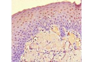 Immunohistochemistry of paraffin-embedded human tonsil tissue using ABIN7149800 at dilution of 1:100 (DET1 antibody  (AA 5-190))