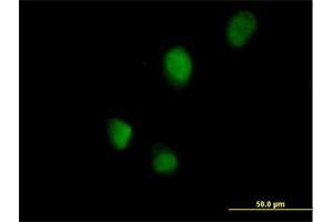 Immunofluorescence of purified MaxPab antibody to RNF113B on HeLa cell. (RNF113B antibody  (AA 1-322))