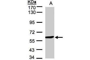 WB Image Sample(30 μg of whole cell lysate) A:Hep G2, 7. (Monoamine Oxidase B antibody)