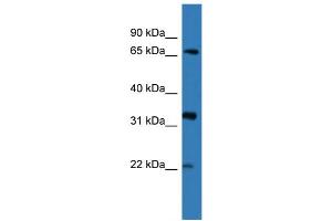 WB Suggested Anti-DOK4  Antibody Titration: 0. (DOK4 antibody  (N-Term))