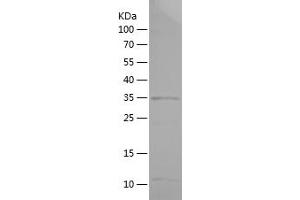 Western Blotting (WB) image for Notch 1 (NOTCH1) (AA 2309-2555) protein (His tag) (ABIN7124195) (Notch1 Protein (AA 2309-2555) (His tag))