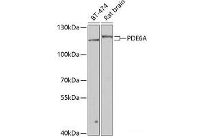 Western blot analysis of extracts of various cell lines using PDE6A Polyclonal Antibody at dilution of 1:1000. (PDE6A antibody)