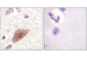 Immunohistochemistry (IHC) image for anti-Tyrosine Hydroxylase (TH) (AA 5-54) antibody (ABIN1532425)