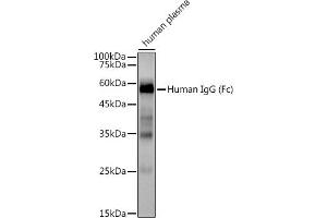 Western blot analysis of extracts of Human plasma, using Human IgG antibody (ABIN7267844) at 1:3000 dilution. (IGHG1 antibody)