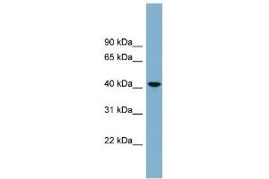 WB Suggested Anti-B4GALT2 Antibody Titration:  0. (B4GALT2 antibody  (Middle Region))