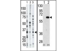 Image no. 1 for anti-Autocrine Motility Factor Receptor (AMFR) (N-Term) antibody (ABIN357584) (AMFR antibody  (N-Term))