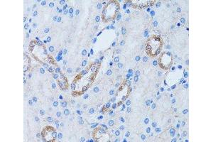 Immunohistochemistry of paraffin-embedded Rat kidney using LDLRAP1 Polyclonal Antibody at dilution of 1:100 (40x lens). (LDLRAP1 antibody)