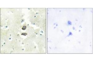Immunohistochemistry analysis of paraffin-embedded human brain tissue, using BRI3B Antibody. (BRI3BP antibody  (AA 1-50))