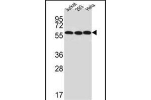 Western blot analysis of UTP6 Antibody (N-term) (ABIN651489 and ABIN2840264) in Jurkat,293,Hela cell line lysates (35 μg/lane).