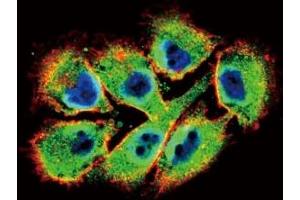 Confocal immunofluorescent analysis of EphB2 antibody with A375 cells followed by Alexa Fluor 488-conjugated goat anti-rabbit lgG (green). (EPH Receptor B2 antibody  (AA 1021-1050))